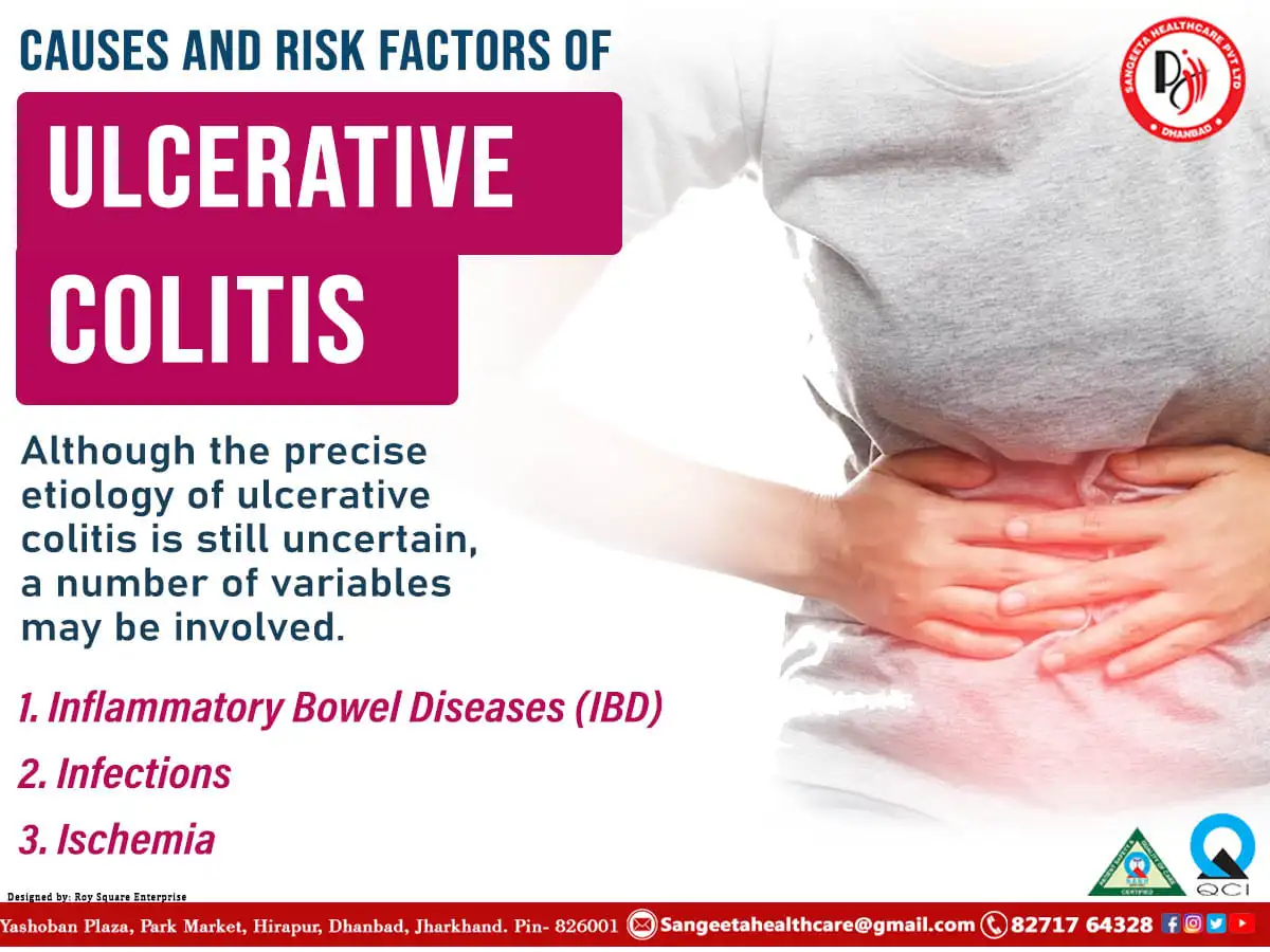 causes-and-risk-factors ulcerative-colitis