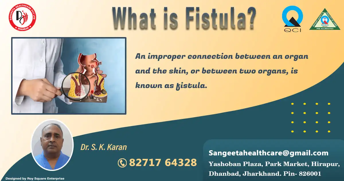 What is Fistulas